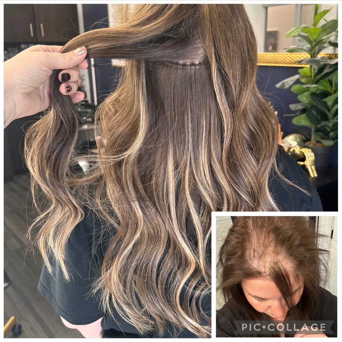 Crown Junkie Hair Replacement Results